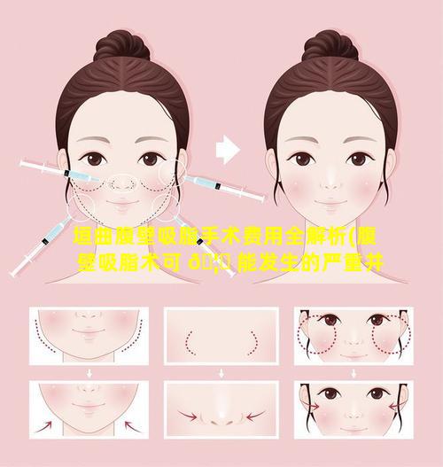 垣曲腹壁吸脂手术费用全解析(腹壁吸脂术可 🦆 能发生的严重并发症为)